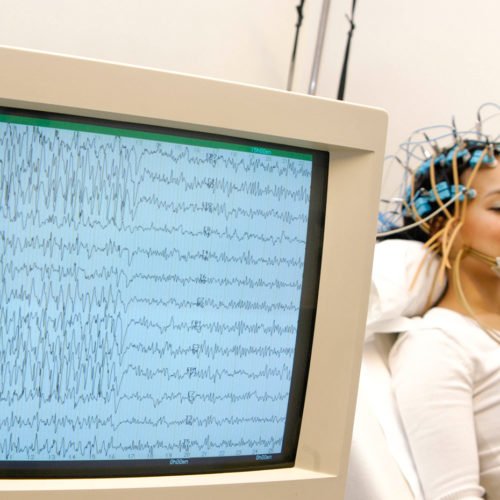 Electroencefalograma (EEG)