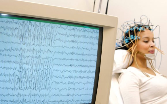Electroencefalograma (EEG)
