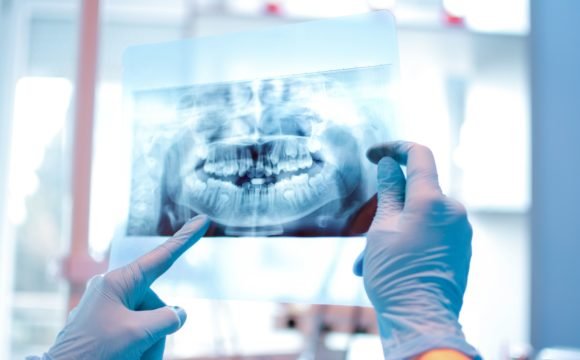 Tomografía Dental y Panorámicas